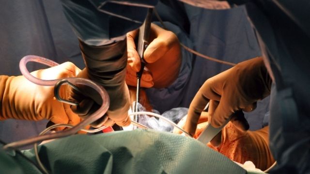 hysteroscopy surgery