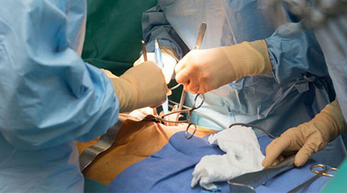 hysteroscopy surgerys