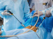 laparoscopy surgery - operation
