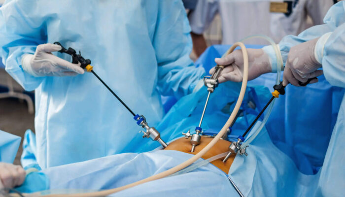 laparoscopy surgery - operation